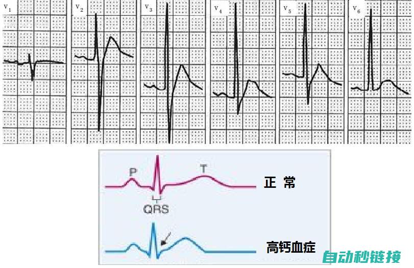 深入剖析STEP 7程序无法启动的原因与应对方法 (深入剖析sw乳胶床垫质量怎么样)